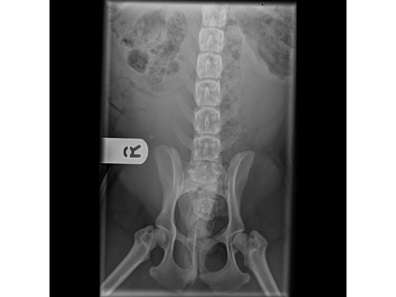 medium-skeletal-10-25-kg-spine-lumbo-sacral-vd-2-28-2021-9-58-52-am-741
